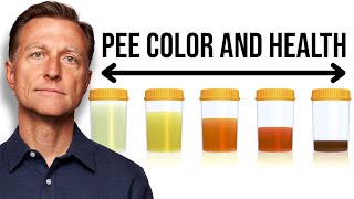 What Your URINE COLOR Says about Your Health [upl. by Aiciruam]