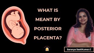 What is a Posterior Placenta  What is meant by Posterior placenta during pregnancy [upl. by Ainej]