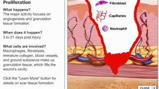 Stages of Wound Healing Process [upl. by Suravart377]