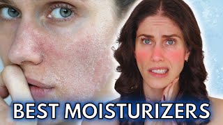 Best Winter Moisturizers [upl. by Notyarb]