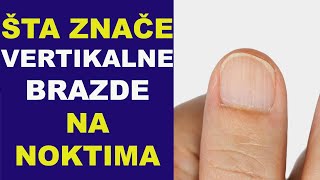 Šta znače VERTIKALNE BRAZDE NA NOKTIMAdr Bojana Mandić [upl. by Serica]