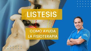 ¿SE CURA LA LISTESIS CON FISIOTERAPIA  ❤ Se amable y califique nuestro trabajo 👍 [upl. by Donovan]