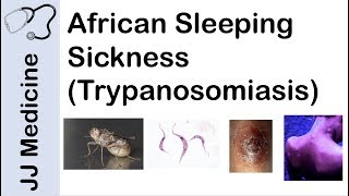 African Sleeping Sickness Trypanosomiasis  Causes Symptoms and Treatment [upl. by Aham]