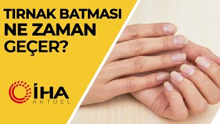 Tırnak Batması Ne Zaman Geçer [upl. by Yrkcaz]