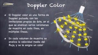 CONOCIMIENTOS BÁSICOS EN ECOGRAFÍA – EL ODIOSO DOPPLER [upl. by Acinomaj600]