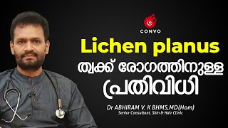 Lichen Planus  Skin disorder amp Treatment  Malayalam  Skin Disease Dr ABHIRAM V K  Convo Health [upl. by Nicolina763]