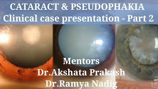 CATARACT amp PSEUDOPHAKIA Clinical case presentation  Part 2 [upl. by Rettig]