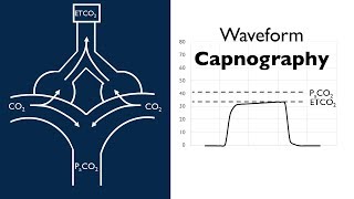 Waveform Capnography  BAVLS [upl. by Eidod226]