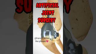 Artificial Joint Implant Surgery bones joints surgery anatomy [upl. by Adnolor602]