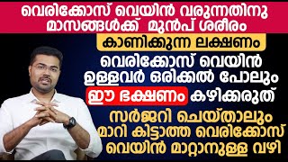 വെരിക്കോസ് വെയിൻ ഉള്ളവർ ഒരിക്കൽ പോലും ഈ ഭക്ഷണം കഴിക്കരുത്  Varicose veins Malayalam [upl. by Ahsiuqet]