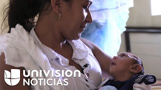 Zika en Brasil la lucha de una madre y su bebé con microcefalia [upl. by Oreves]