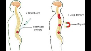 Intrathecal Route of Drug Administration  Uses Procedure Advantages Disadvantages [upl. by Names]