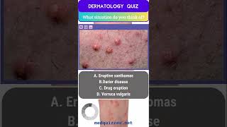 Cutaneous Signs and Diagnosis Quiz  Part 1 medicalmcqs dermatologyquiz [upl. by Rehpotsyrhc462]