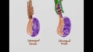 Knee injury Injuries  Everything You Need To Know  Dr Nabil Ebraheim [upl. by Garaway840]