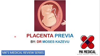 Placenta previa [upl. by Aivlys]