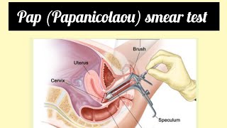 PAP SMEAR TEST  screeningtest cervix reproduction gynaecology cancer [upl. by Ydderf]