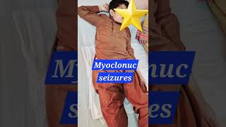 Myoclonic seizures  Myoclonus  SSPE  Epilepsy pediatrics neurology doctor [upl. by Zarger]