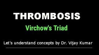 Thrombosis Pathology  Virchows Triad  Thrombus Formation  Pathology Lectures [upl. by Dinerman]