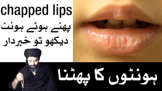 Chapped Lips Hont Phatain to Khabardar Mehrban Ali  Mehrban TV [upl. by Aicssej]