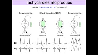 ECG indispensables en SAMU et urgence Partie 3 Tachycardies Dr Taboulet [upl. by Georgianna]