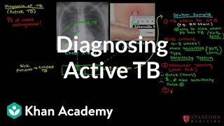 Diagnosing active TB  Infectious diseases  NCLEXRN  Khan Academy [upl. by Grossman]