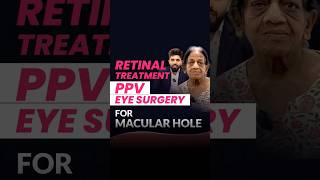 Eye Surgery for Macular Hole in Retina [upl. by Sukul]