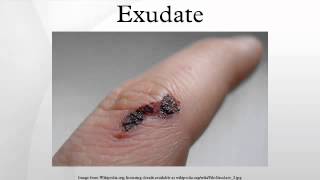 Exudate [upl. by Winfield]