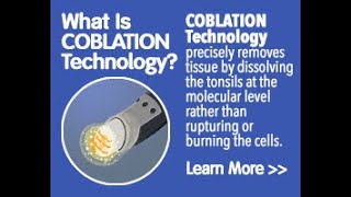 Coblation assisted adenoidectomy [upl. by Freedman]