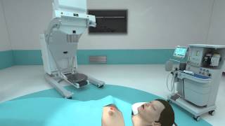 Mobetron®  Intraoperative Electron Radiation Therapy IORT [upl. by Ativet]