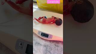 Premature baby weight 625 Gmnicu medical viralshorts [upl. by Ellehsat]