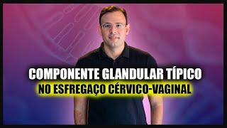 Citologia Componente GLANDULAR típico no esfregaço cervico vaginal 2021 [upl. by Aisile440]