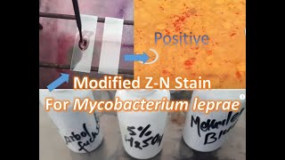 Modified ZiehlNeelsen for Leprosy causative agent Mycobacterium leprae [upl. by Pollard874]