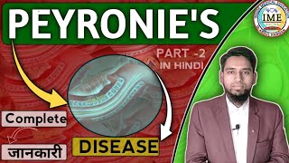 All About Peyronies Disease Homoeopathic medicine for Peyronies diseasepeyroniesdisease [upl. by Enrak]