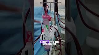 How Hemodialysis Filters Blood  Quick Overviewhemodialysis kidneydialysis dialysistreatment [upl. by Ilrac119]