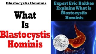 What Is Blastocystis Hominis  Ask Eric Bakker [upl. by Annawahs]