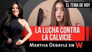 Martha Debayle  Tema Una LUCHA contra la CAÍDA de CABELLO  W Radio [upl. by Aiepoissac]