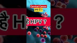 cervical cancer क्या है  shorts cervicalcancer hpvvaccine [upl. by Yorgen585]