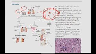 Mycobacteria Tuberculosis Leprosy  Microbiology  14  First Aid USMLE in UrduHindi [upl. by Peskoff]