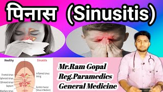 Sinusitisपिनासcauses symptoms How to treat sinusitis in nepali [upl. by Panayiotis]