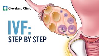 How Does In Vitro Fertilization IVF Work A StepbyStep Explanation [upl. by Theone147]