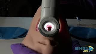 VieScope First Pass Intubation Success Rates that eclipse any VideoLaryngoscope [upl. by Airogerg]