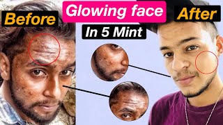 How To Get Glowing Skin For Men  Skin Care Tips For Boy In Hindi  Grooming Tips For Men  🔥 [upl. by Picker]