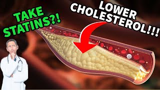 Lower Your Cholesterol  Steroids and Statins  Should You Take A Statin  Doctors Analysis [upl. by Niatsirk716]