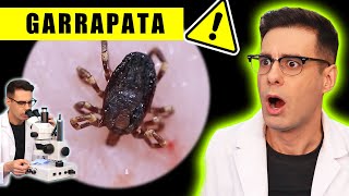 GARRAPATA Picando Bajo el Microscopio 😱  Curiosidades con Mike [upl. by Bathsheb298]