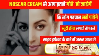 No Scars Cream Remove Face pigmentation Melasma Acne amp Pimples MarksNo scars cream review in hindi [upl. by Konstanze847]