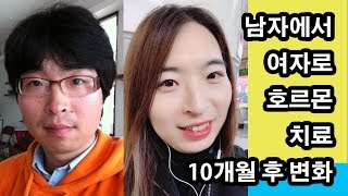 남자에서 여자로 호르몬 치료 10개월 후 변화 MTF HRT after 10 Months  Transgender 트랜스젠더 [upl. by Igal900]