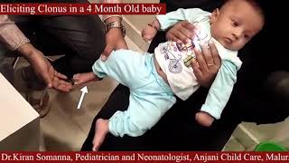 Demonstration of clonus in an Infant [upl. by Arahahs]