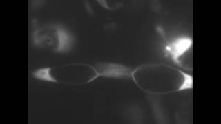 Double extrusion of Chlamydia [upl. by Hashim]