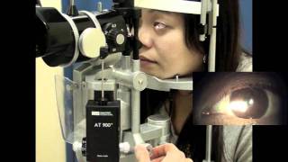 Part 3 Using a Slit Lamp [upl. by Jacie]