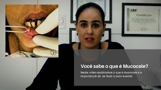 Você sabe o que é Mucocele [upl. by Rambort]